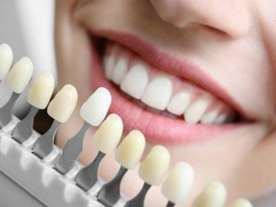 Địa chỉ bọc răng sứ Tân Phú giúp bạn vượt qua nỗi sợ khám răng